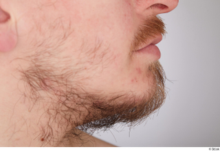 Sigvid bearded chin mouth 0002.jpg